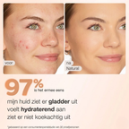 Van Lynden | Tinted Moisturizer met SPF 30