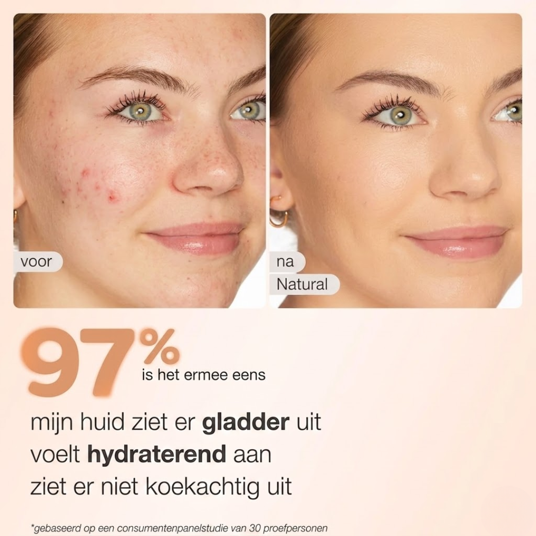 Van Lynden | Tinted Moisturizer met SPF 30